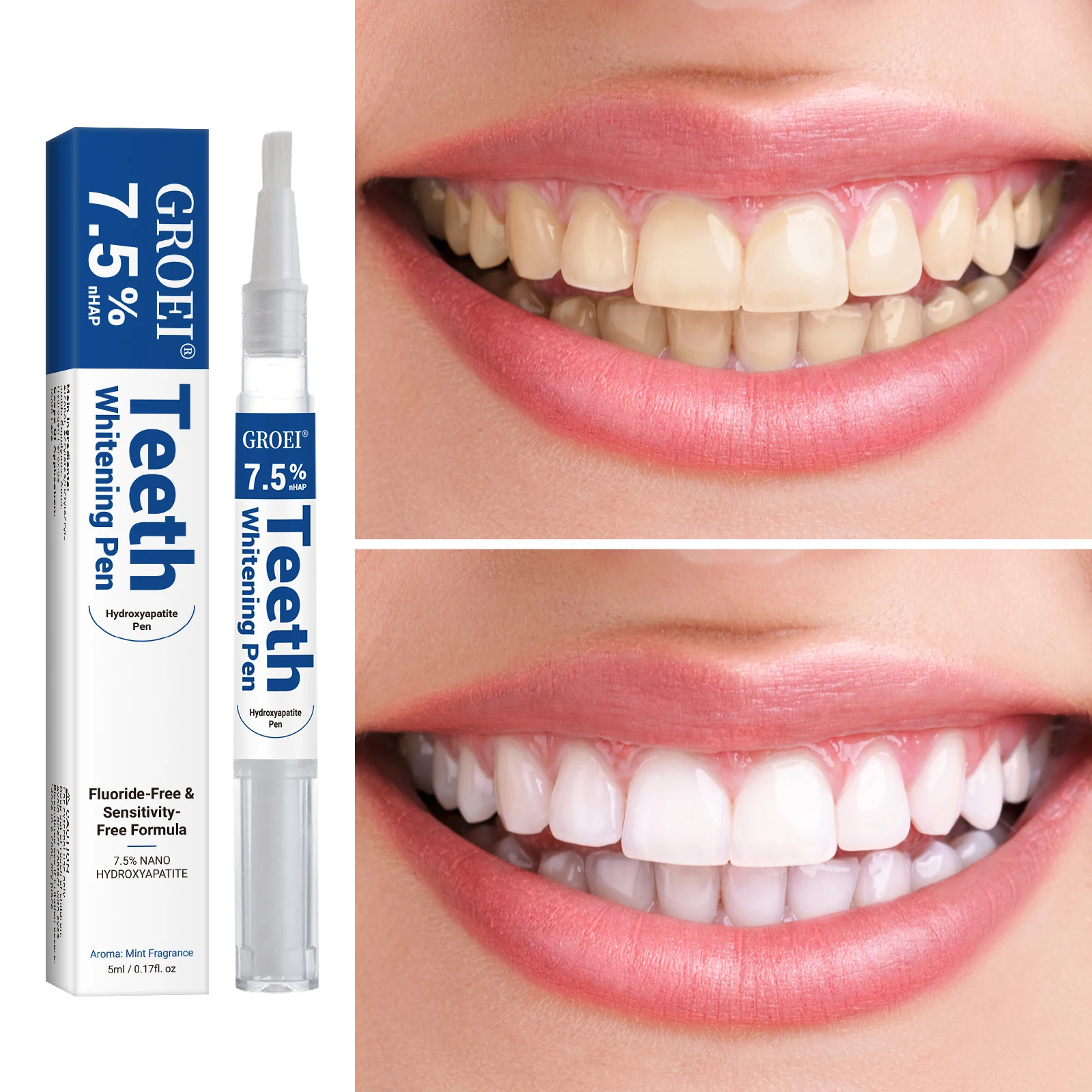 Caneta branqueadora de dente h - Teeth Whitening Gel Peroxide avaliação e preço