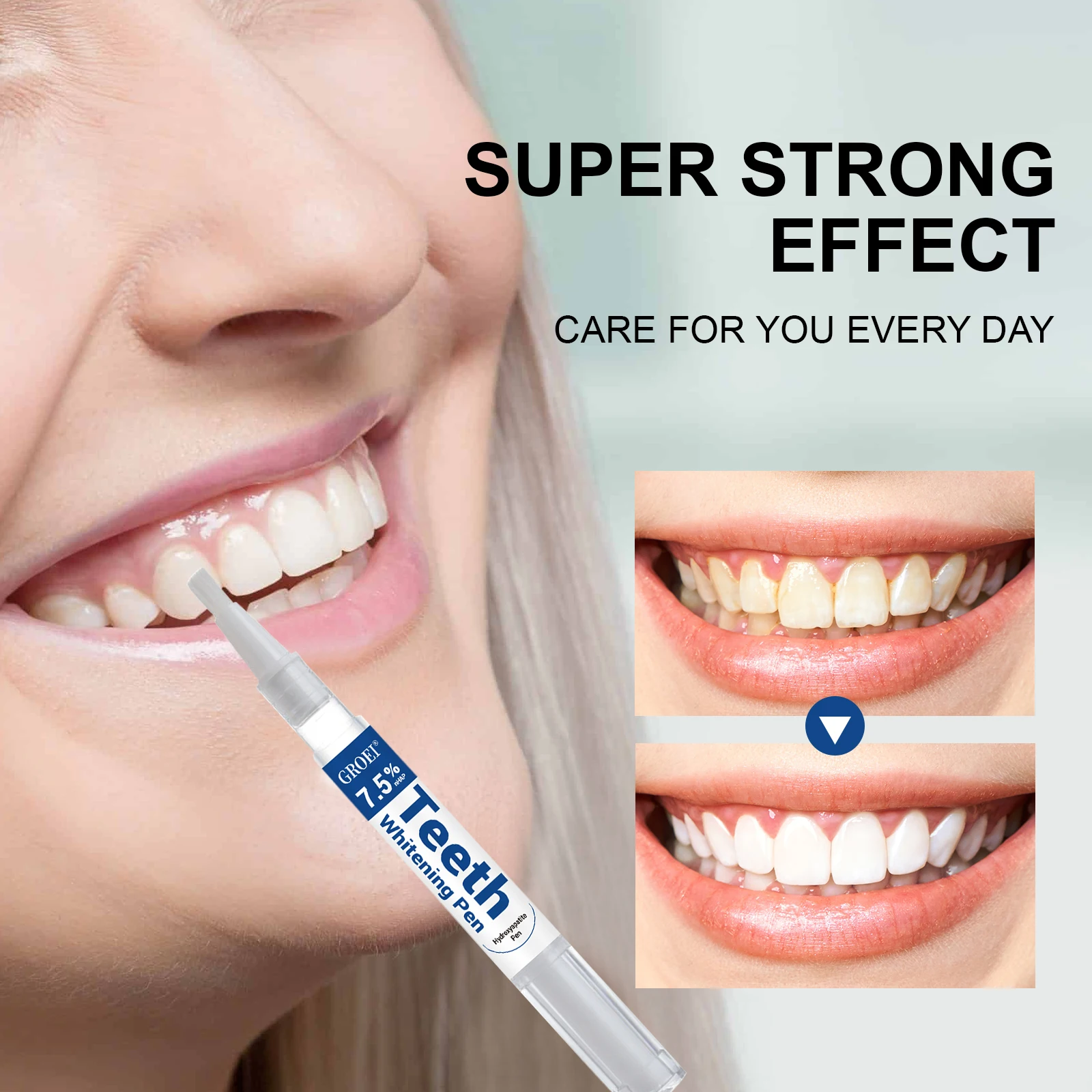 Caneta branqueadora de dente h - Teeth Whitening Gel Peroxide avaliação e preço