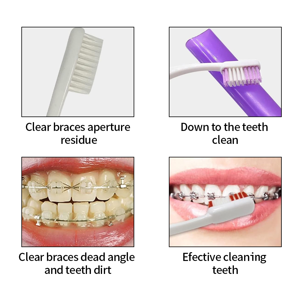 8 pçs/set ortodôntico kit esco - Teeth Whitening With Braces avaliação e preço