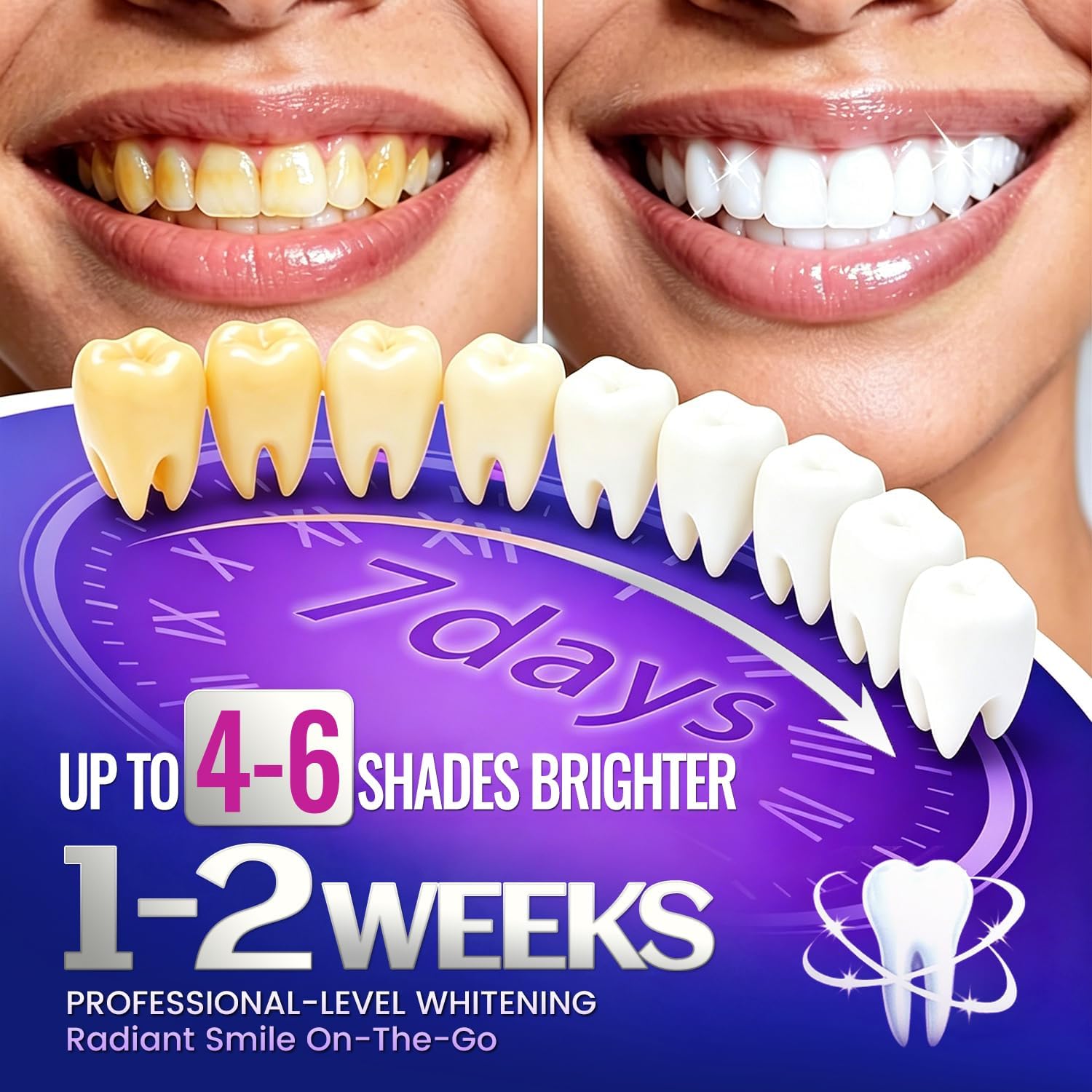 7 pares de tiras clareadoras d - Teeth Whitening Retainer avaliação e preço