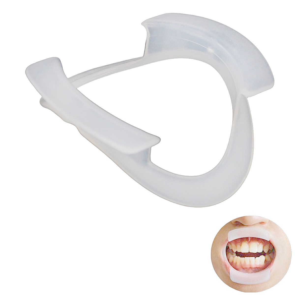 100 unidades/saco Abridor Buca - Teeth Whitening With Braces avaliação e preço
