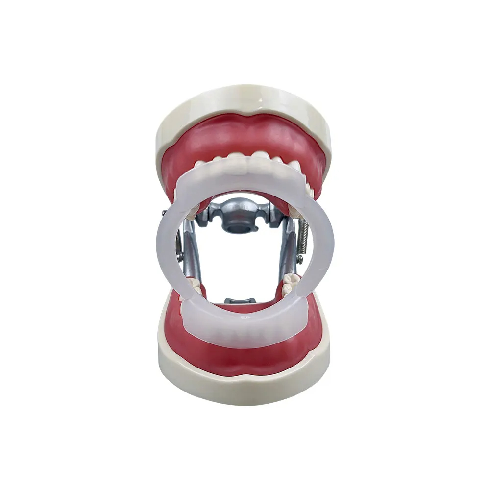 100 unidades/saco Abridor Buca - Teeth Whitening With Braces avaliação e preço