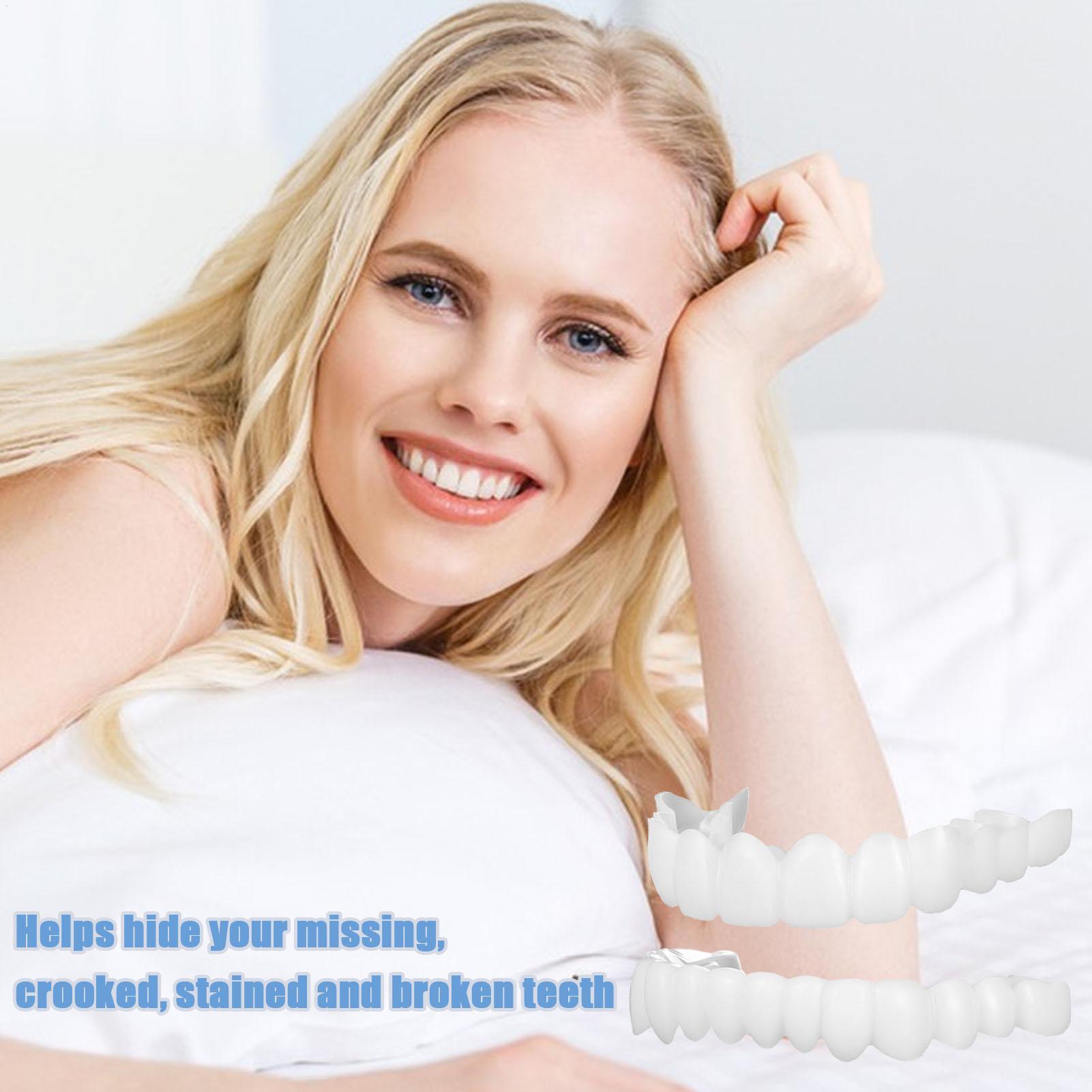 Capa Dentária Superior e Infer - Teeth Whitening With Braces avaliação e preço