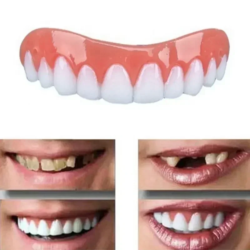 Novas Próteses Dentárias de Si - Teeth Whitening With Braces avaliação e preço