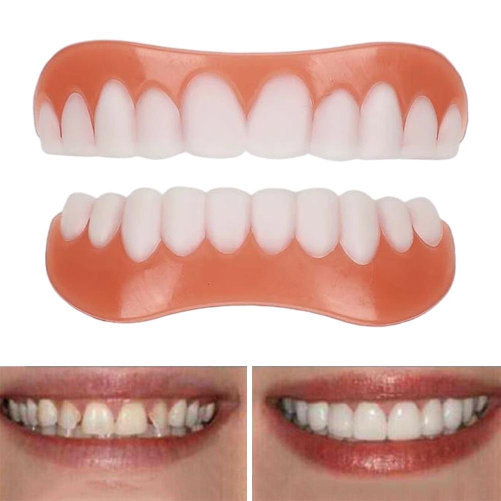 Novas Próteses Dentárias de Si - Teeth Whitening With Braces avaliação e preço