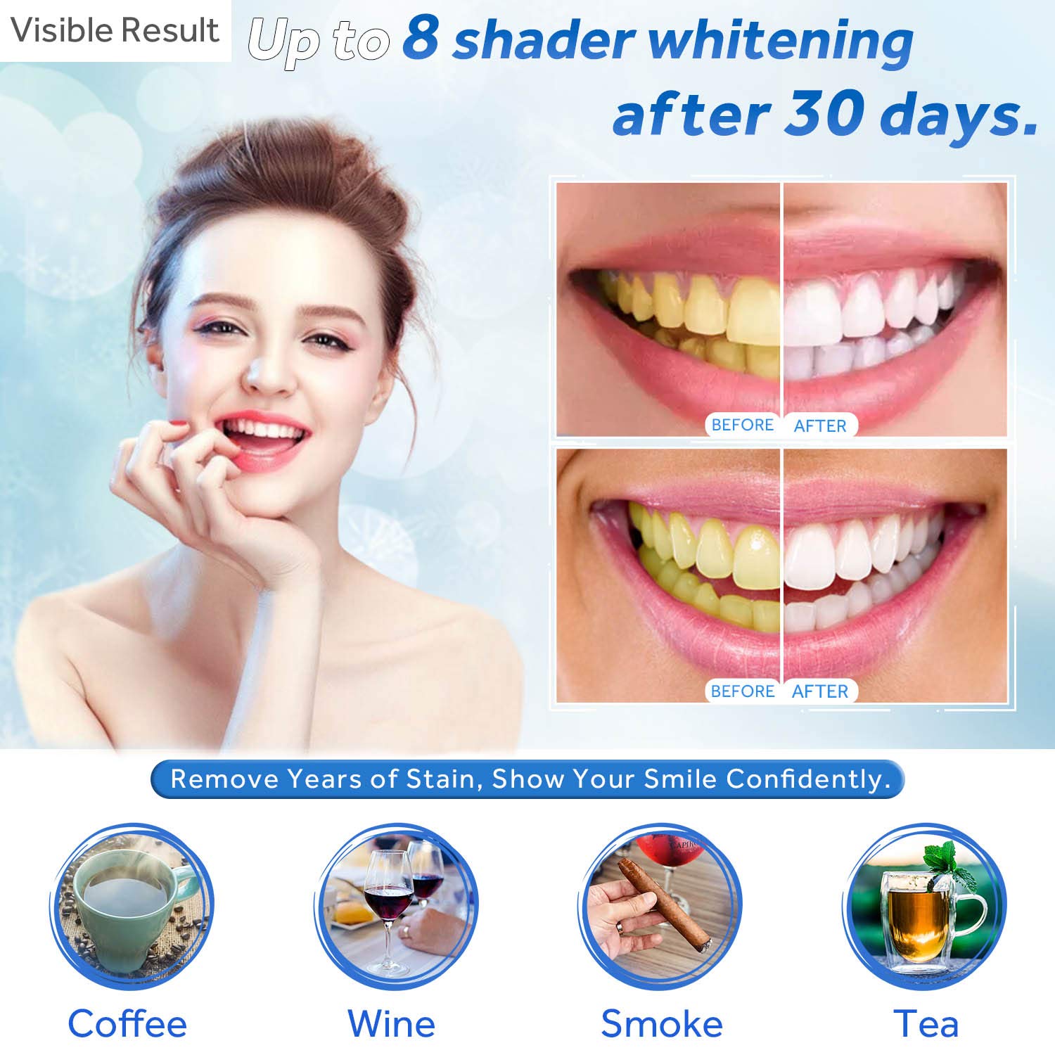 Seringa de recarga de gel para - Teeth Whitening Gel Peroxide avaliação e preço