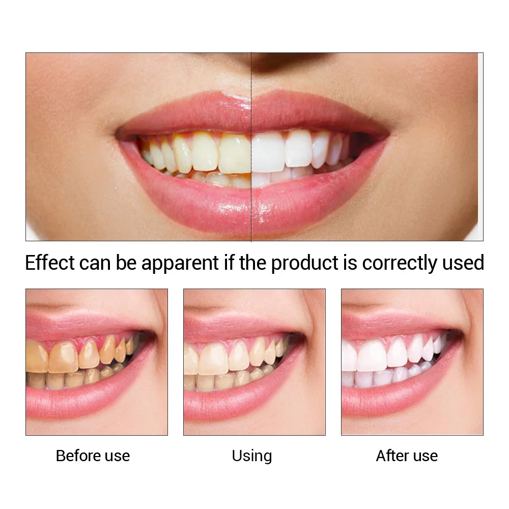 FTEENPLY Essência para claream - Teeth Whitening Ingredients avaliação e preço
