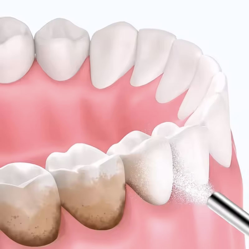 Pó para Jato de Areia Dental 1 - Teeth Whitening Ingredients avaliação e preço