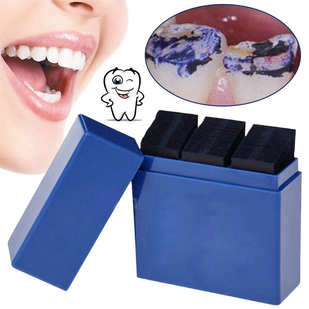 300 Folhas de Papel Articulado - Teeth Whitening Retainer avaliação e preço