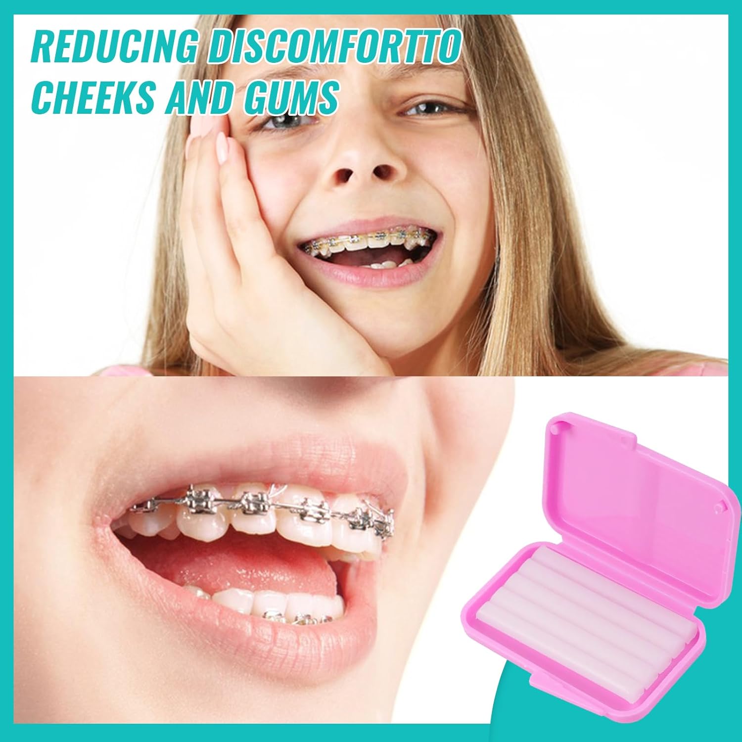 10 caixas de cera ortodôntica  - Teeth Whitening With Braces avaliação e preço