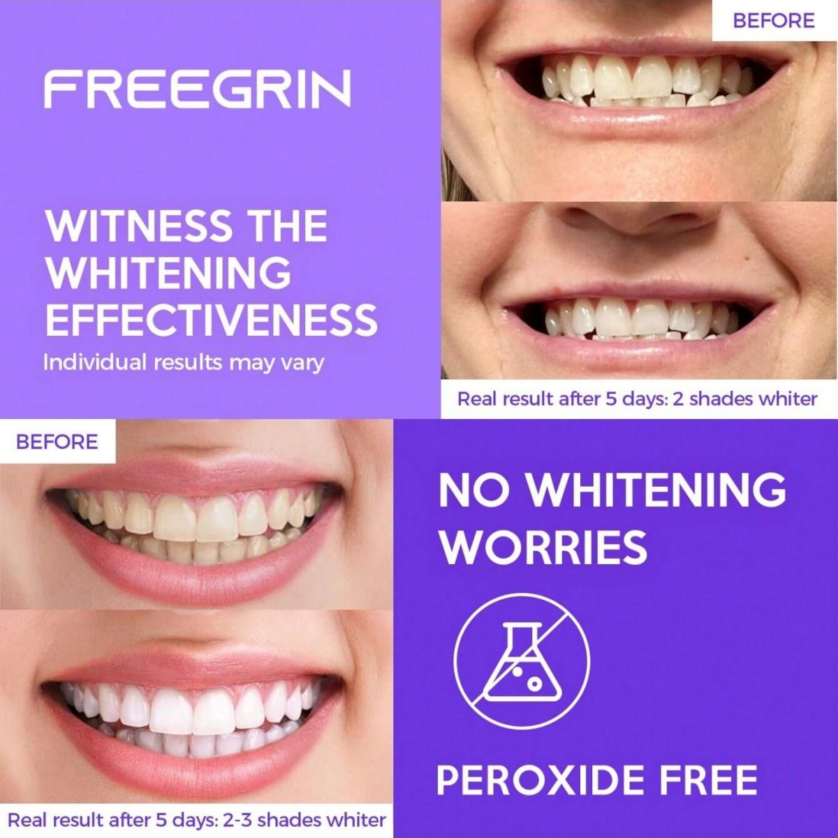Adesivos de clareamento dental - Teeth Whitening Gel Refills avaliação e preço