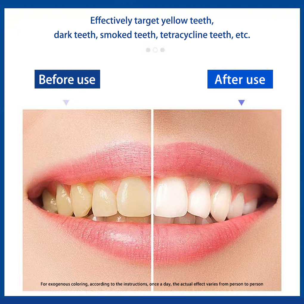 70/140 pares 5d tiras de clare - Teeth Whitening Effects avaliação e preço