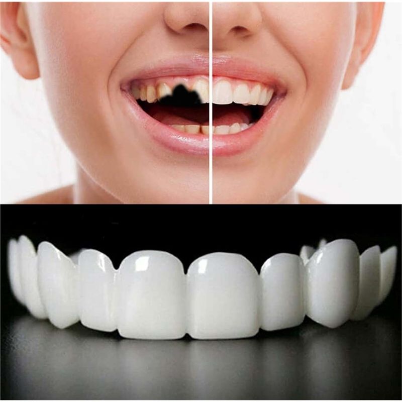 [NOVO! ABMK】 2 Pares, Restaure - Teeth Whitening With Braces avaliação e preço